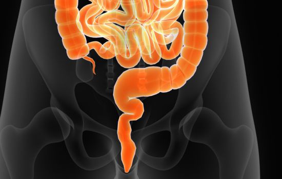 Mastdarmvorfall - Rektumprolaps - Rektumvorfall - Mastdarmprolaps